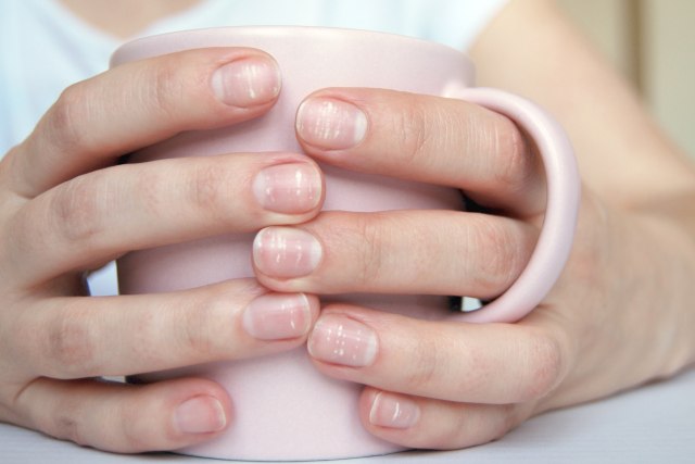 Bele mrlje na noktima mogu da budu znak ozbiljne bolesti